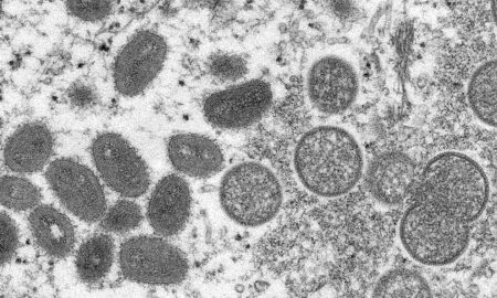 Demand for monkeypox vaccine grows in U.S., European countries as virus cases climb