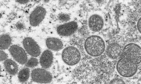 US military service member in Germany is military's first case of monkeypox