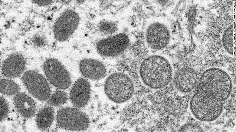 US military service member in Germany is military's first case of monkeypox