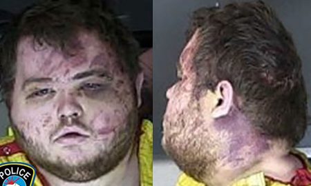 Mugshot of Colorado gay club shooting suspect shows injuries sustained during confrontation with 'heroic people'