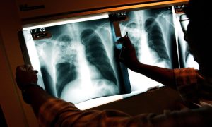 Breaking News: NYC's Race to Control Tuberculosis Surge