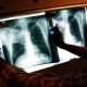 Breaking News: NYC's Race to Control Tuberculosis Surge